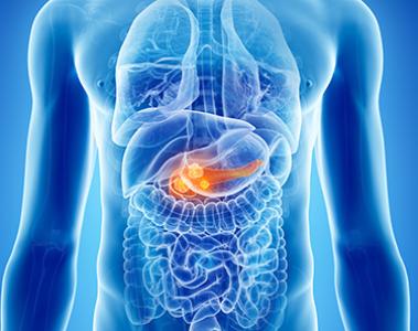 Pancreatic Cancer